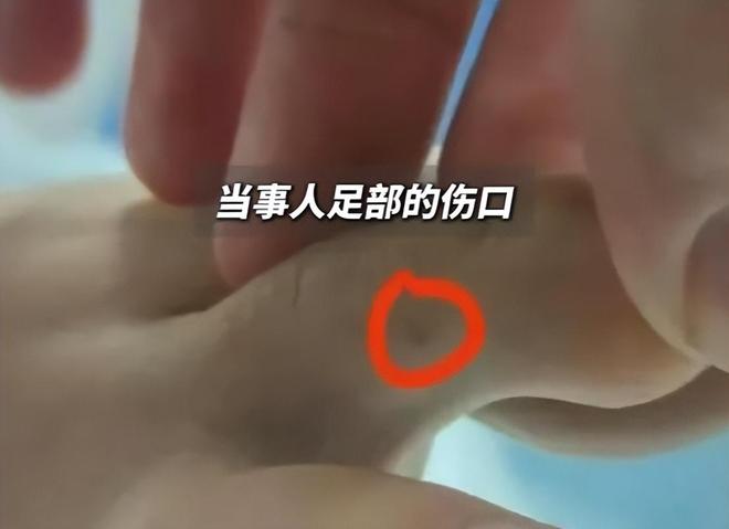 三亚女子被咬最新进展:医院曾被罚款百万家属发声或准备尸检(图5)