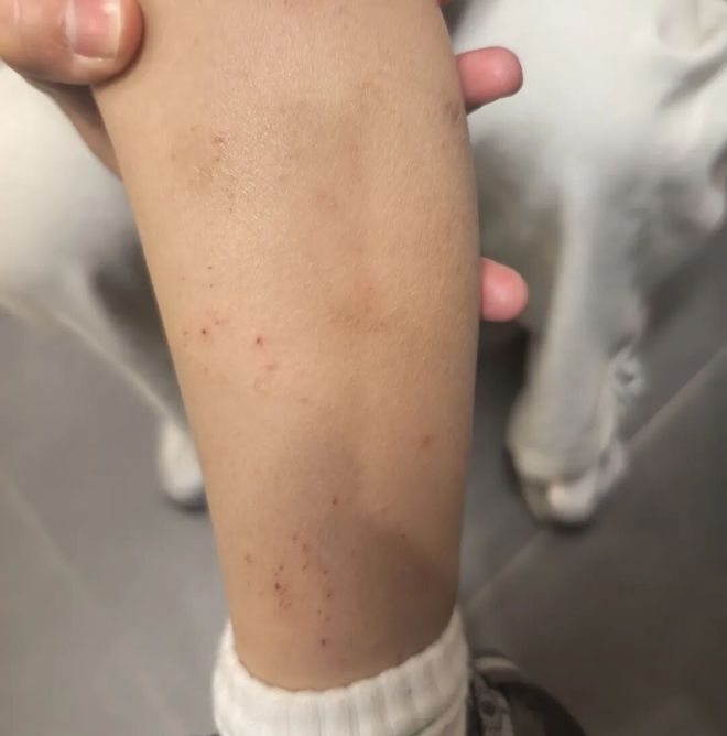 市区一小区自来水为何发黄发臭多日？还有刺鼻异味(图2)