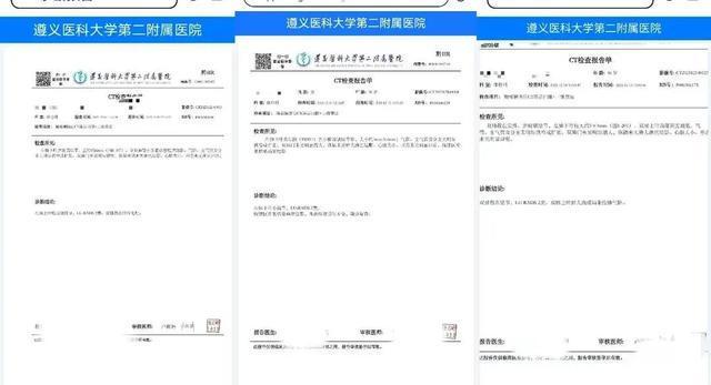 贵州一小区自来水变蓝8个月拆卸的管道内发现油漆状物质20多人检出身体异常回应(图5)