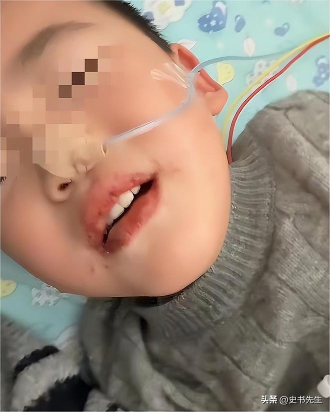 Kaiyun体育网站：江苏一奶奶误将疏通剂喂孙子妈妈悲痛发声细节被扒网友震怒(图5)